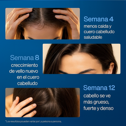 Roll-On AntiCaida – BodyWise -Estimulación activa del crecimiento capilar desde la raíz