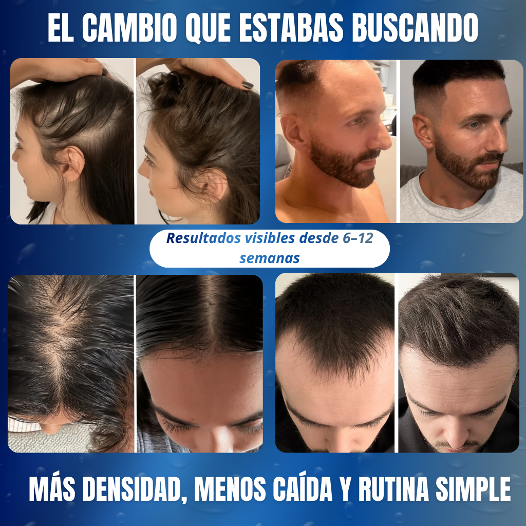 Roll-On AntiCaida – BodyWise -Estimulación activa del crecimiento capilar desde la raíz