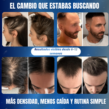 Roll-On AntiCaida – BodyWise -Estimulación activa del crecimiento capilar desde la raíz