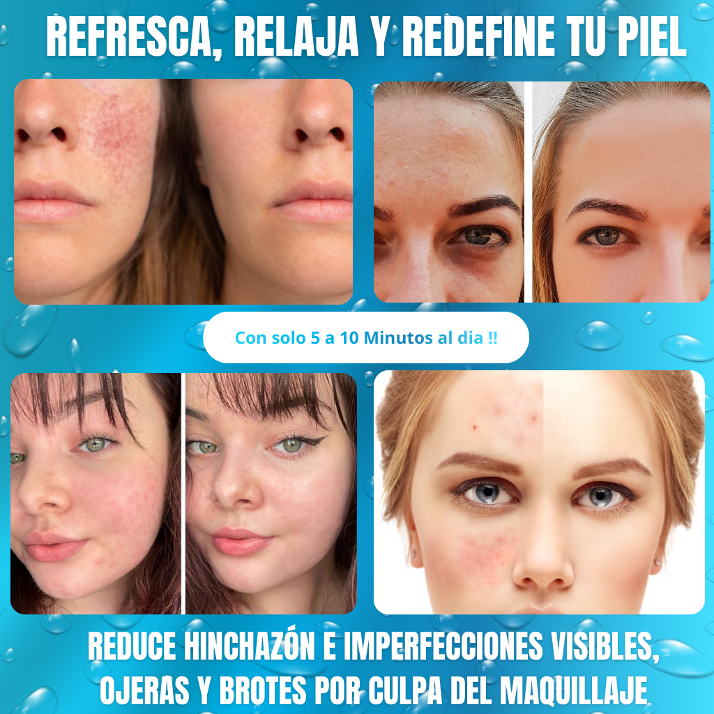 Ice Roller ™ Renueva, Refresca,Revive y Resplandece tu rostro en 5 minutos al día