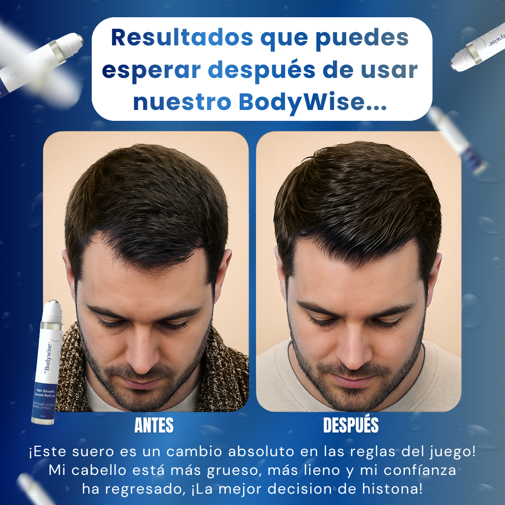 Roll-On AntiCaida – BodyWise -Estimulación activa del crecimiento capilar desde la raíz