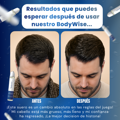 Roll-On AntiCaida – BodyWise -Estimulación activa del crecimiento capilar desde la raíz