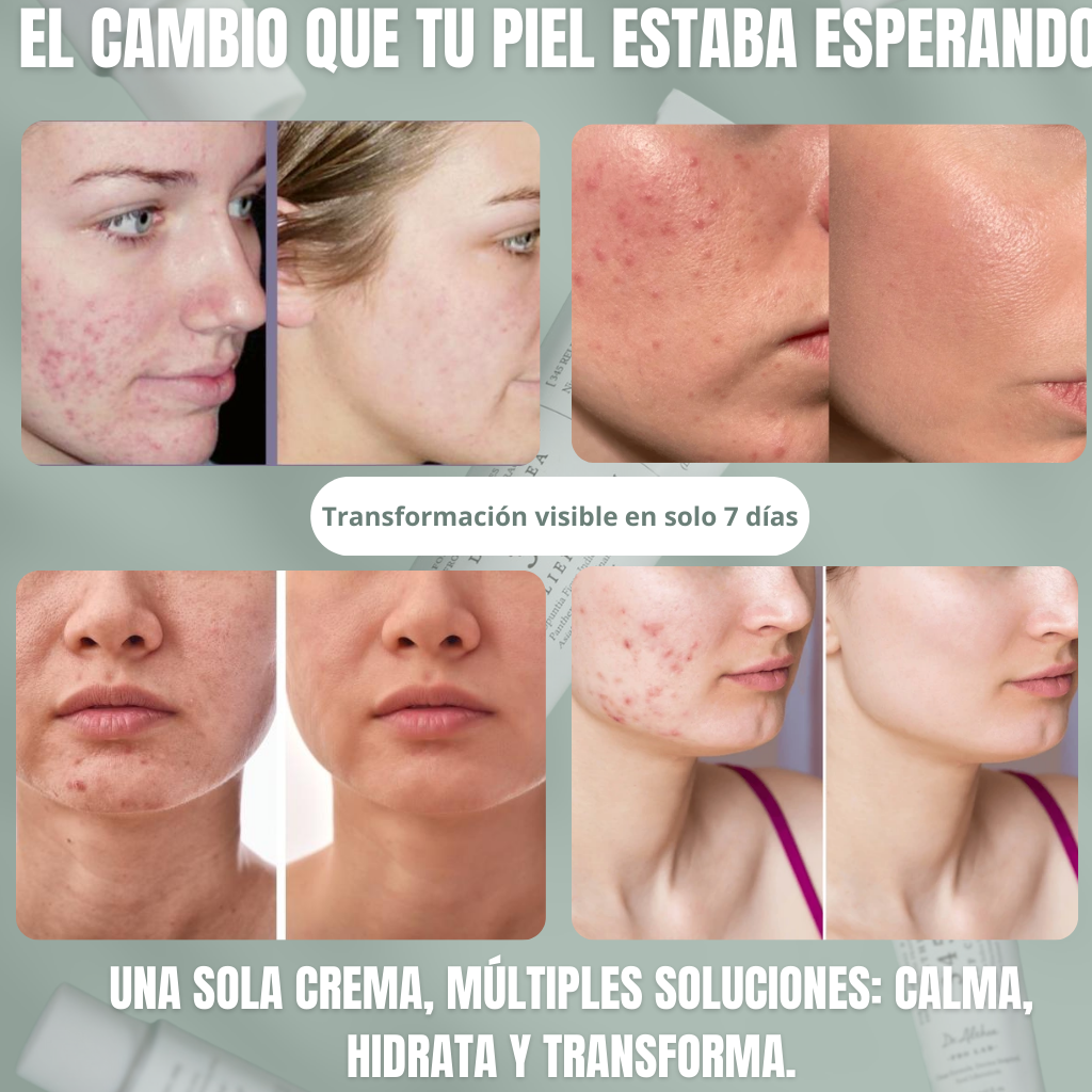Cream 345 Relief - Dr. Althea (60ml) -Cuidado avanzado para piel sensible e irritada